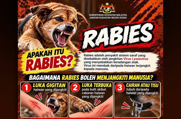 Kedah human rabies died